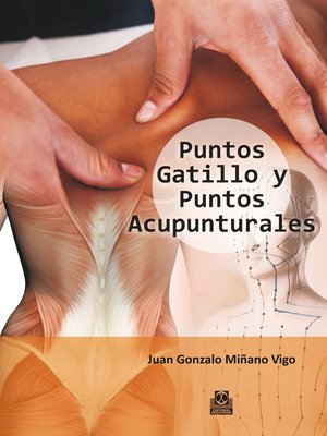 cover image of Puntos gatillo y puntos acupunturales (Color)